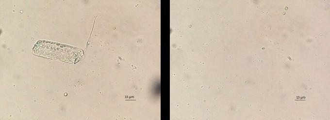 Slika : mikroskopiranje - negativna kontrola vhod Videli smo le različne mikroalge. Slika levo verjetno ne prikazuje alge vendar le neko tvorbo. Povečava: 400 X 4.3.
