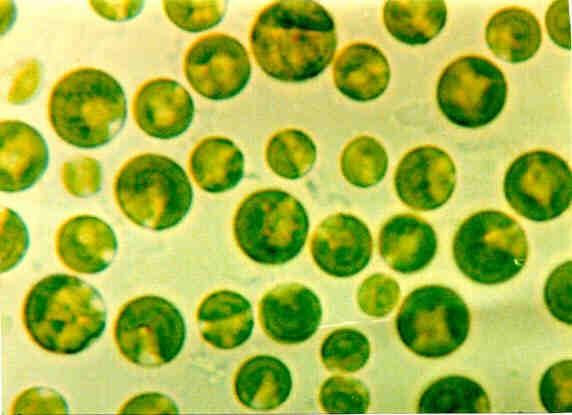 5.1.4 Chlorella Chlorella spada v družino zelenih alg Chlorellacae. Ima okroglo obliko in je velika 2-10 μm, nima bičkov s katerimi bi se lahko premikala. Slika : celice alge Chlorella 5.1.4.1 Zgodovina Alga Chlorella je postala zanimiva, kot vir hrane že v štiridesetih letih prejšnjega stoletja, ko je predstavljala možno hrano za hitro naraščajoče število ljudi.