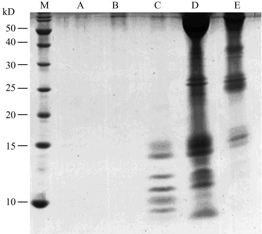 1 89 Tricine-SDS- 2 60% PAGE Fig 2 15 kd 2 3 Tricine-SDS-PAGE 2 1% Fig 2 Tricine-SDS-PAGE of plasma peptide samples extracted by different methods Five methods were used to extract endogenous