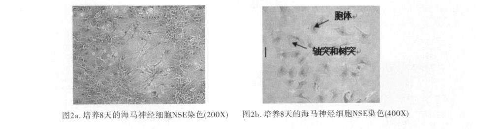 5 ~ 1 10 7 / 1. 5. 6 Western Blot ml 96 150ul 24 1ml 6 2ml GCR BDNF SGK DBI CO 2 24h neurobasal + BCA B27 49 1 8 6 n = 4 Nissl NSE 20μl 1. 5. 2 30μg 10 Nissl 6 n = 6 4% SDS-PAGE 5% 1 Nissl 37 4 PBST 37 45 30min 2 95% 5 70% PBST ECL NSE 6 2 n = 6NSE SP 2.