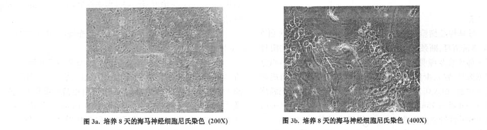 18 NSE 2b 2a 2. 2. 2 nissl 2. 3 SYTO13-PI 3a 3b SYTO13 PI 2 SGK BDNF GCR /β-actin x 珋 ± s 4 n SGK BDNF GCR 4 0. 774 ± 0. 028 0.