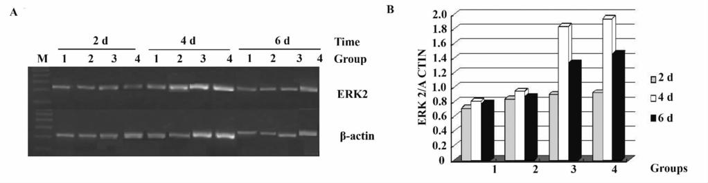 320 2014 30 2 Fig. 2 LS174T ERK2 RT-PCR Volume ERK2 /Volume β-actin ERK2's RT-PCR results of LS174T cells and column chart according to ratio of volume ERK2 / Volume β-actin NoteA.