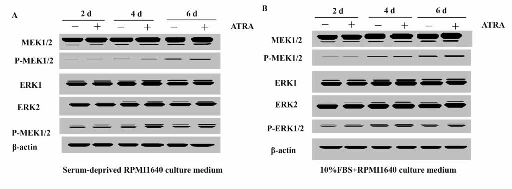 RPMI1640 medium contained 10% fetal bovine serum4. RPMI1640 medium + 10% fetal bovine serum + 10-5 mol /L ATRA. B. Statistical chart of ERK2 /ACTIN P < 0. 05. 3 Fig.