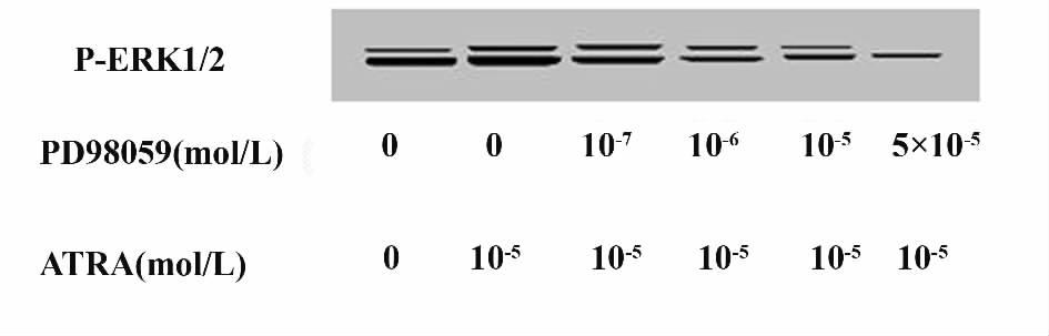 LS174T colon cancer cells to increase as above. Western blot analysis of MEK1 /2p-MEK1 /2ERK1ER2p-ERK1 /2 during different treatment. β-actin is used as a lane loading control.