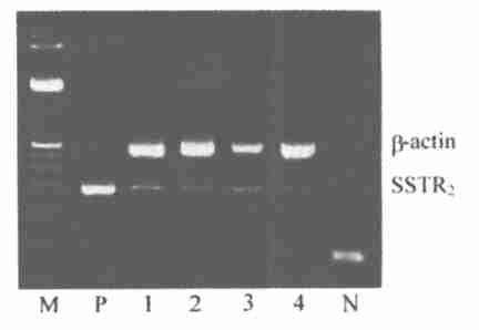 252 GAG CCC AAA GAA GGC AGG CT23, 222 bp [2 ] 2actin 5 2GGC ATC GTG ATG GAC TCC G23, 5 2GCT GGA AGG TGG ACA GCG A23, 613bp PCR (Biometra, ) 37, 72 7min 94 45s, 64 45s,72 45s 94 45s,65 45s,72 45s PCR