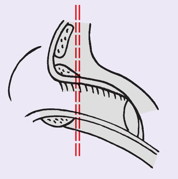 Ανατοµία ωτός 11 A Μείζον ωτιαίο νεύρο (Α2, Α3) B Ωτιαίος κλάδος του πνευµονογαστρικού κενό μεταξύ της έλικας και του τράγου και ονομάζεται πρόσθια εντομή (Incisura).