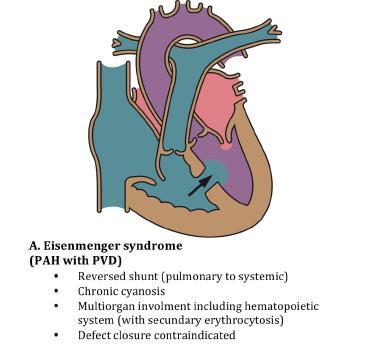 ΣΥΝΔΡΟΜΟ EISENMENGER Μεγάλα καρδιακά ελλείμματα με αρχικά διαφυγή L R.