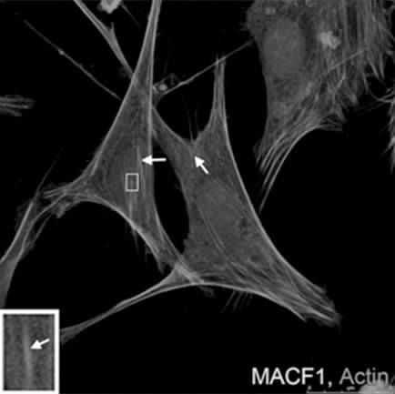 MACF1, 25 μm Fig1