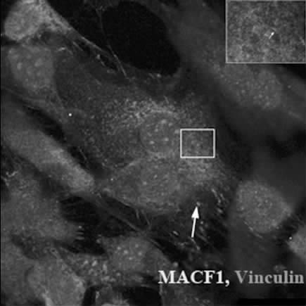 tubulin in MG-63