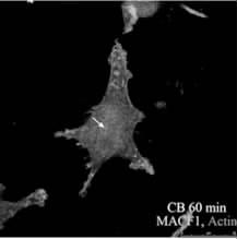 25 μm Fig2  