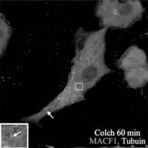 sirna-macf1 MACF1 MG-63 scramble sirna 4D