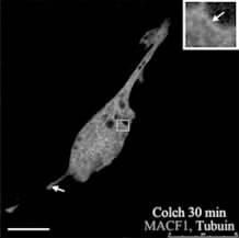 association of MACF1 with microtubule