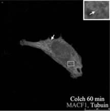 treated with colchicines Bar 25 μm 4