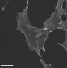 25 μm Fig4 The effects of si-macf1 on