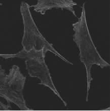 filaments C D in MG-63 and MC3T3 cells by
