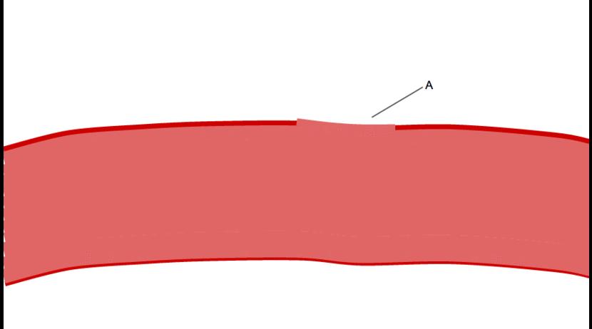 The ligands, denoted by letter L, signal for platelets (P) to migrate towards the wound (Site A).