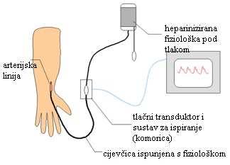 1. Intraarterijsko mjerenje krvnog tlaka 12 Indikacije učestale kontrole krvnog tlaka zbog inducirane hipertenzije ili hipotenzije cirkulacijski