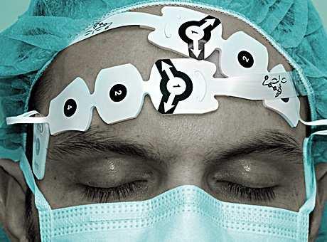 29 Nadzor središnjeg živčanog sustava (stanje svijesti) Senzor postavljen na čelo prenosi EEG signale