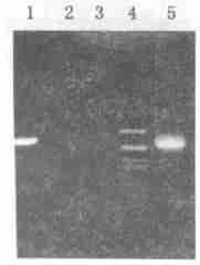 2 GUS positive of rolc2transformed tobacco plant leaf ) 1, DNA, 3 rolc PCR Fig. 3 PCR amplification detection 1, 21 rolc DNA ; 31 DNA ; 41marker ; 51 rolc 1 and 2.