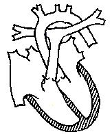 Έλλειμμα μεσοκολπικού διαφράγματος Atrial Septal Defect (ASD) Τα ελλείμματα μεσοκολπικού διαφράγματος (ΑSDs) αποτελούν επίσης συχνή μορφή συγγενούς καρδιοπάθειας (10-15%), με σχεδόν διπλάσια ποσοστά