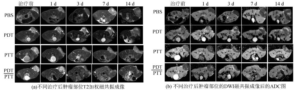 apparent diffusion coefficient ADC DWI ADC PBS 34 44 MRI ADC 14 d 4 ~ 5 2 a ADC 7 d ADC GO - PEG - Ce6 24 h Fig