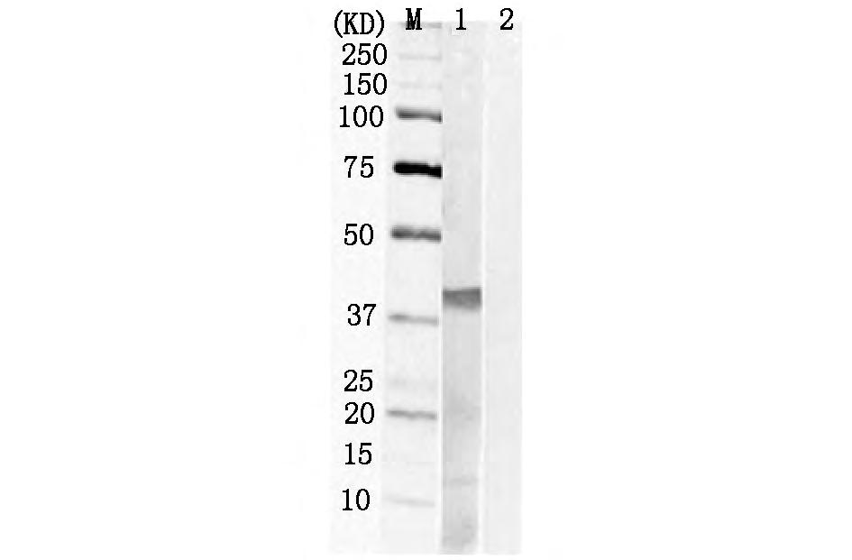 Cpred Prediction IgE 2 4 2 ELISA 4 36 ~ 51 44 ~ 59 81 ~ 96 107 ~ 122 HRP IgE TMB 131 ~ 146 ~ 161 189 ~ 204 234 ~ 249 257 ~ 272 H 2 SO 4 OD 450 5