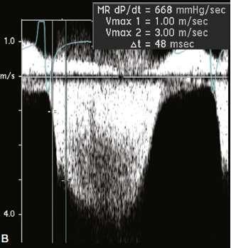 Hemodynamic