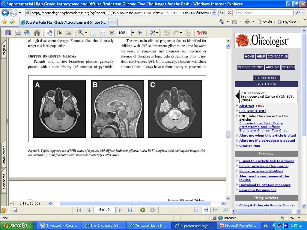 Διάχυτα γλοιώματα στελέχους Diffuse Intrinsic Pontine Glioma (DIPG) H3 K27M μεταλλάξεις