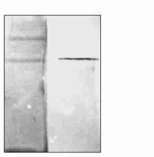 784 17 Fig 3 Sephadex G250 chromatography of HLMT The curve indicates size exclusion chromatography moni2 tored by A 280 The elution buffer was 50 mmolπl Tris2HCl, ph 810, with flow rate of 30 mlπh
