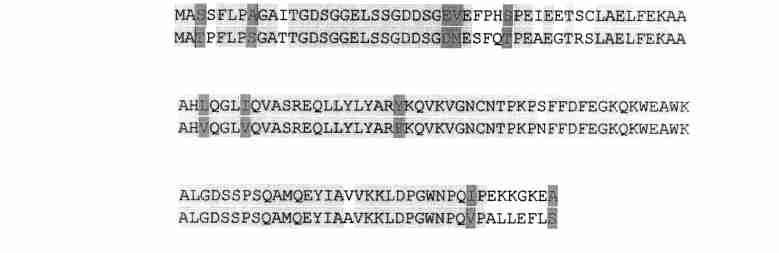 2 : ACB P5 cdna Π 167 Fig 1 cdna sequence of the human ACBP5 gene Coding sequences are shown together with the translated amino acid sequence Initiative code (ATG) and stop code (TGA) are underlined