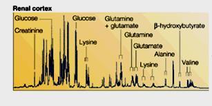 Metabonomics: a