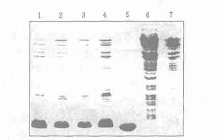 3SD S-PAGE ana lysis of target prote in W hole cell lysates of DH 5Α containing pbv 2202hP2 MU T2; 5. p roinsulin; 6.