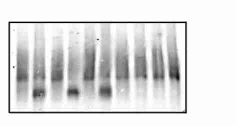 min at 25 ) and then heat activated (lane 3) and diamide2 and DTT2 treated (5 mmolπl 5 min at 25 ) and then heat activated (lane 4) conditions For the comparison aliquots of HeLa cell extract trated