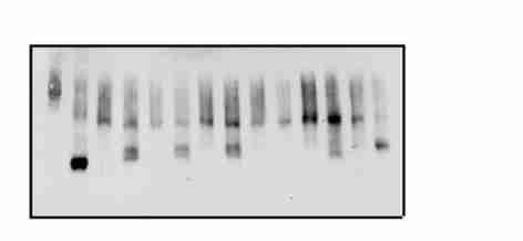 ( 8 10 ) HSF1 Fig 1 HSF1 C 153 C 373 C 378 ox2hsf1 ox2hsf1 WT yes yes C 36 Y yes yes C 105 Y yes yes C 153 S no no C 373 S no yes C 378 S yes no Fig3 Resolution and detection of redox conformers of