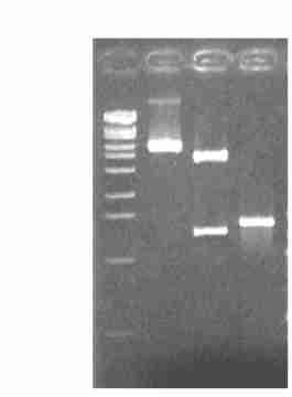 56 21, cdna 114 kb GenBank BLAST, (, Fig11) cdna, BM2518 Cre loxp ptriplex 3,, TriplEx cdna ptrip2 HBsAg2B P 3 ptriplex ( Fig12) EcoR Xba, 315 kb ptrip2 HBsAg2B P XL12Blue, 1 (ptriplex ) 112 kb (