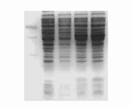 DNAΠEcoT 14I marker ;1 Recombinant plasmid ; 2 Recombinant plasmid digested with EcoR and Xba ; 3 PCR product of positive phage Fig 3 SDS2PAGE analysis of the expression product M Protein molecular