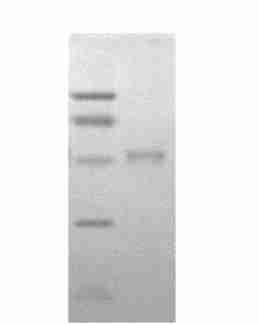 Recombinant induced for 6 hours by 10 and 1 mmolπl IPTG, respectively ; 4,5 Recombinant induced for 4 5 hours by 10 and 1 mmolπl IPTG,respectively Fig 7 ELISA analysis of purified recombinant