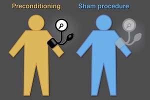 scans N=189 RIPC: Remote Ischemic Preconditioning Phase 2 RCT N=189 (1:1:1): Control group, Sham group (60 mm