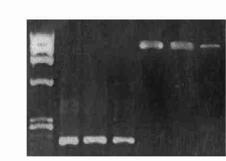 6 : RNA 817 1 4, 3 5, 1 6, 6 M A S4 (, P < 0105) : M PC 0159 cm 01496 g,m A S4 0117 cm 01082 g, M PC (P < 01055) F ig.