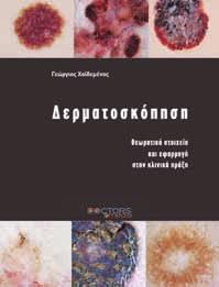 Φωτοθεραπεία - Ψυχολογική υποστήριξη - Θεραπευτική εκπαίδευση ΣΥΜΠΕΡΑΣΜΑΤΑ Συχνότερη δερματοπάθεια παιδιών (περίπου 15 %) Εξωγενής (αλλεργικός) και ενδογενής τύπος Θεραπευτικός στόχος η διακοπή της
