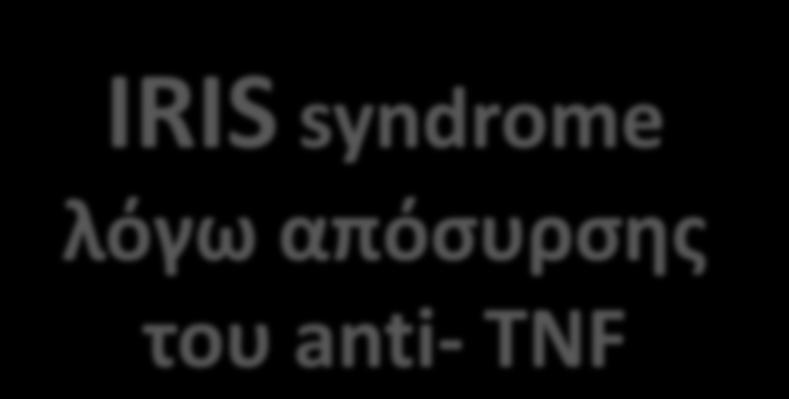 2012 IRIS syndrome?