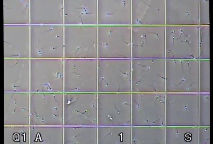 Καλυπτρίδα με πλέγμα εμβαδού 1 mm², υποδιαιρεμένο σε 100 τετράγωνα, 0.1 x 0.1 mm το καθένα.