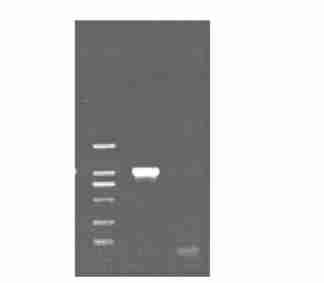 1 : 67 1174 bp ( Fig 1), kinase phosphorylation site), 58 60 80 82, pmd2182t 276 278 C, pmd2ul41 (protein kinase C phosphorylation site),vhs (Fig 2) Fig 1 Amplification of UL41 gene M: DNA Marker