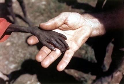 Κοκκαλιασμένο χεράκι παιδιού της Αφρικής πανω σε χερι λευκού ανθρώπου (1980) Ένας