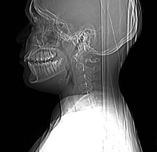 Τοπόγραμμα Orientation: head first supine Length: 300