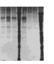 as2 toris exp ressed in flasks Stained w ith silver salts D, H:M o lecular m ass m arker, indicated in kd A, B, C, E: Exp ression m edia of N o 6, 18, 24, 30 strains harbo ring the p lasm id py IS21
