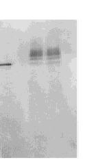 (F ig 5) F ig 5 W estern blat analysis of PA I21 exp ressed in P p ostoris A : Purified PA I21 exp ressed in E coli B, E: Exp ression m edia of N o 31 and 36 strains, as negative contro ls C, D: Exp