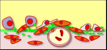 Lesion Epithelial &