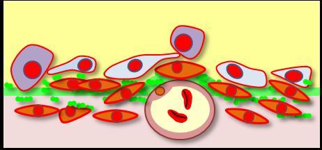 Pneumocyte type II