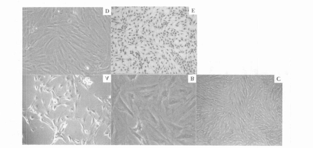 8 : 41 2 A. 7 h (100 ) ; B. 2 d (400 ) ; C. 3 d (50 ) ; D. 3 d (100 ) ; E. H E (100 ) F ig. 2 R ats Serto li cells of different culture tim es A.